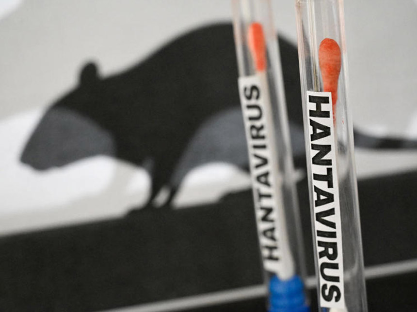 Hantavirus